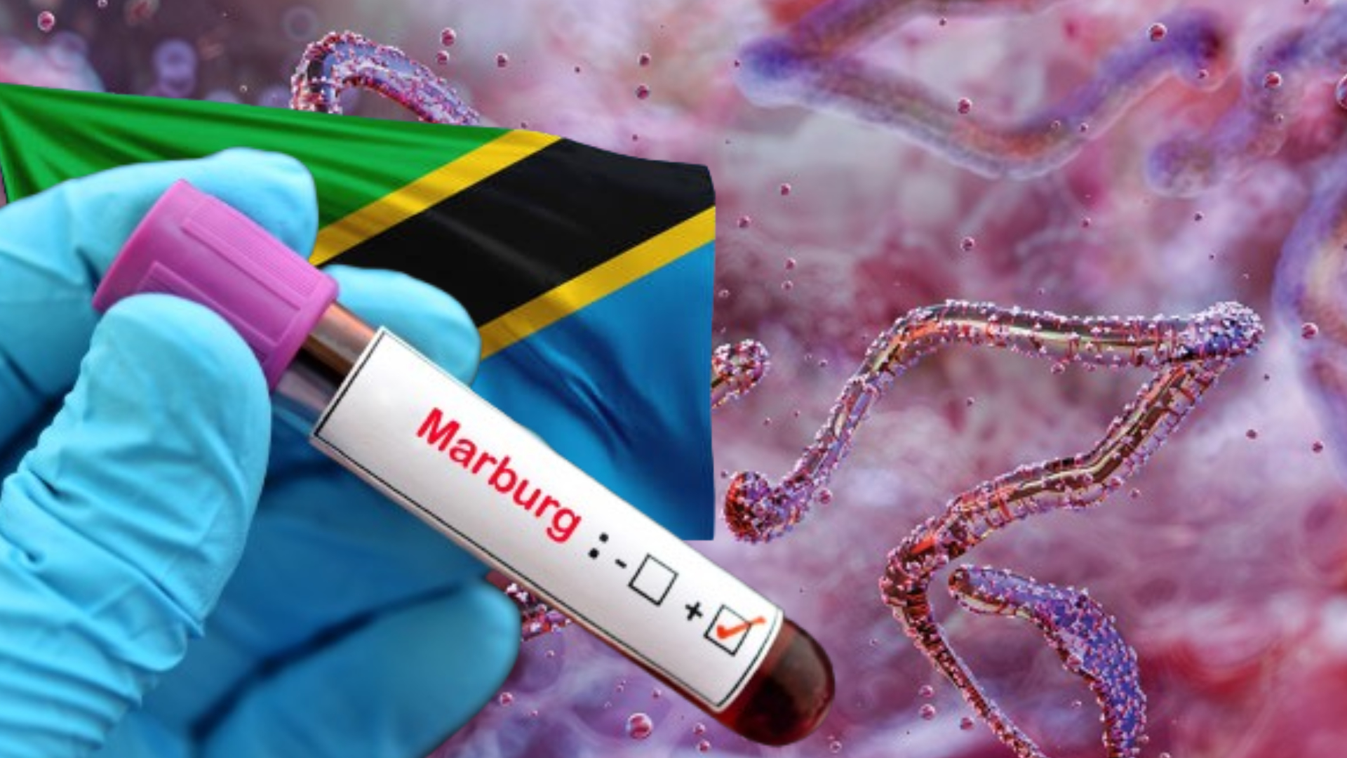 Eight Dead in Suspected Marburg Outbreak in Tanzania: WHO